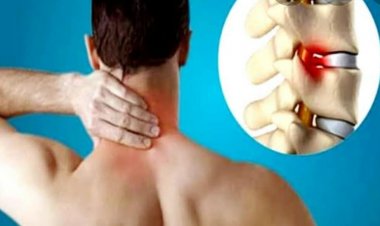सर्वाइकल स्पॉन्डोलाइटिस : जब गर्दन को हिलाना-डुलाना भी हो जाए मुश्किल