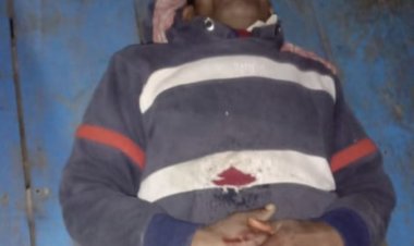 अज्ञात बदमाशो ने मजदूर को मारा गोली