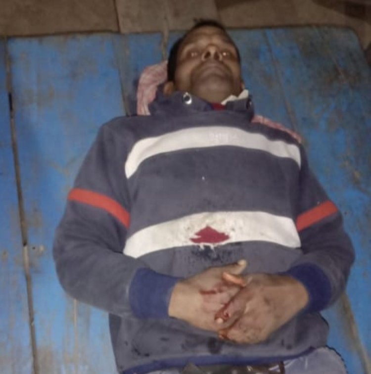 अज्ञात बदमाशो ने मजदूर को मारा गोली