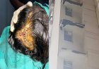 ग्रेट वैल्यू शरणम सोसाइटी में हुआ हादसा, मेड के सिर पर गिरा RCC का टुकड़ा, लगे 12 टांके